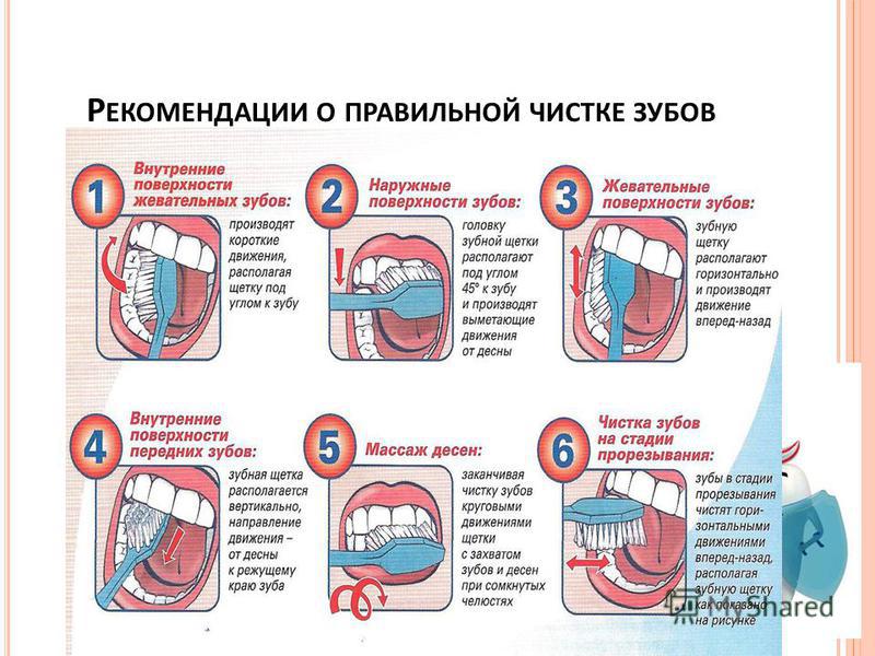 Как правильно чистить зубы картинки