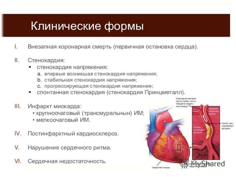 Коронарная смерть причины у мужчин. Шунтирование коронарных артерий сердца. Коронарное шунтирование операция. Аортокоронарное шунтирование (АКШ). Коронарная недостаточность и ИБС.