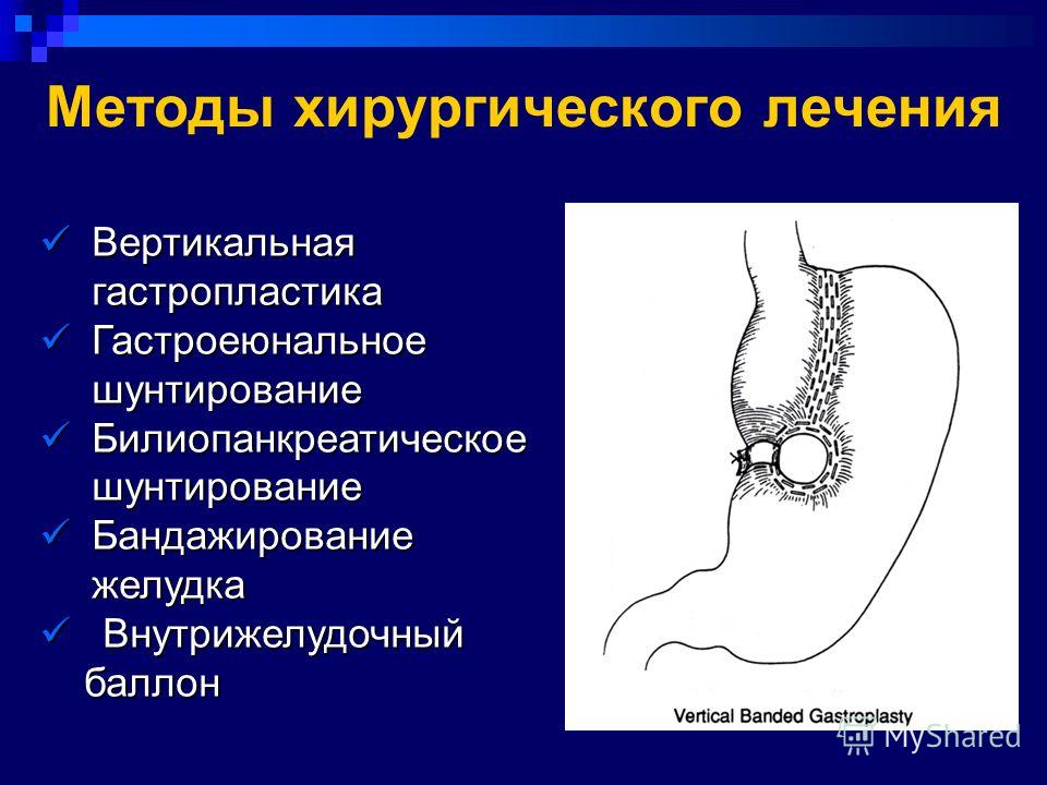 Методы хирургии