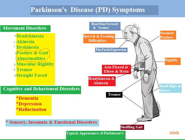 Симптомы паркинсона у женщин. Болезнь Паркинсона симптомы у мужчин. Parkinson disease Symptoms. Parkinson's disease Symptoms. Паркинсон стадии болезни Паркинсона у мужчин.