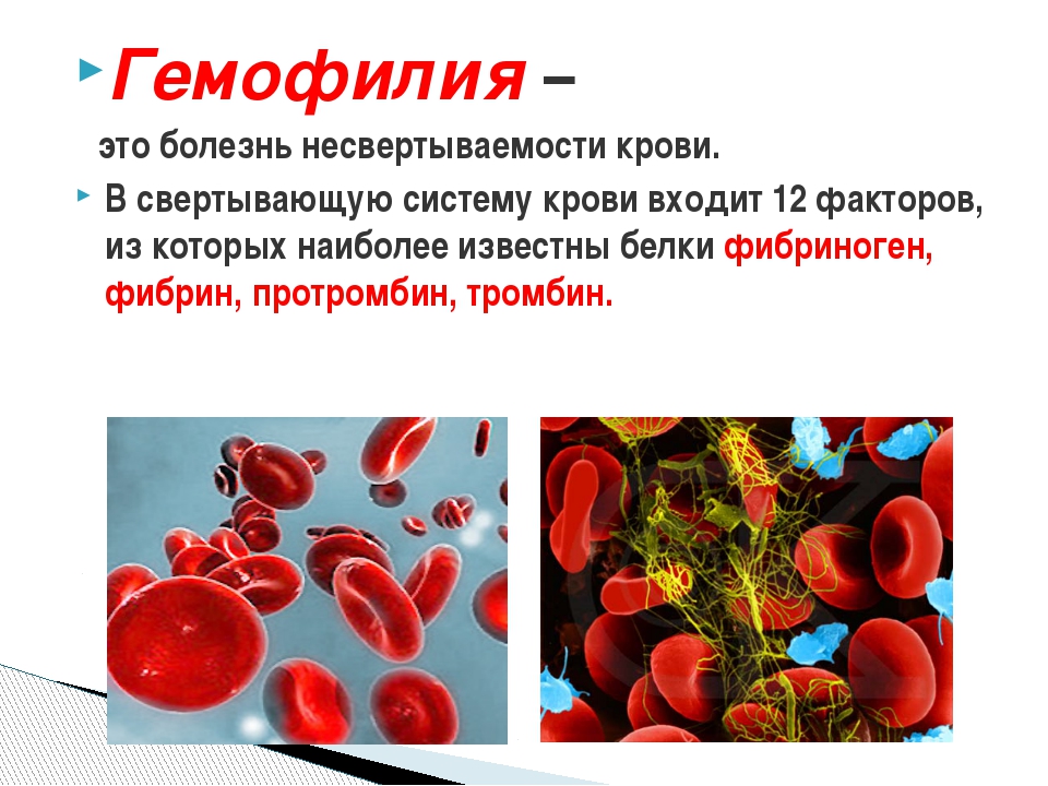 Причины нарушения крови. Плохая свертываемость крови. Гемофилия и заболевание крови. Болезнь несвёртываемости крови.