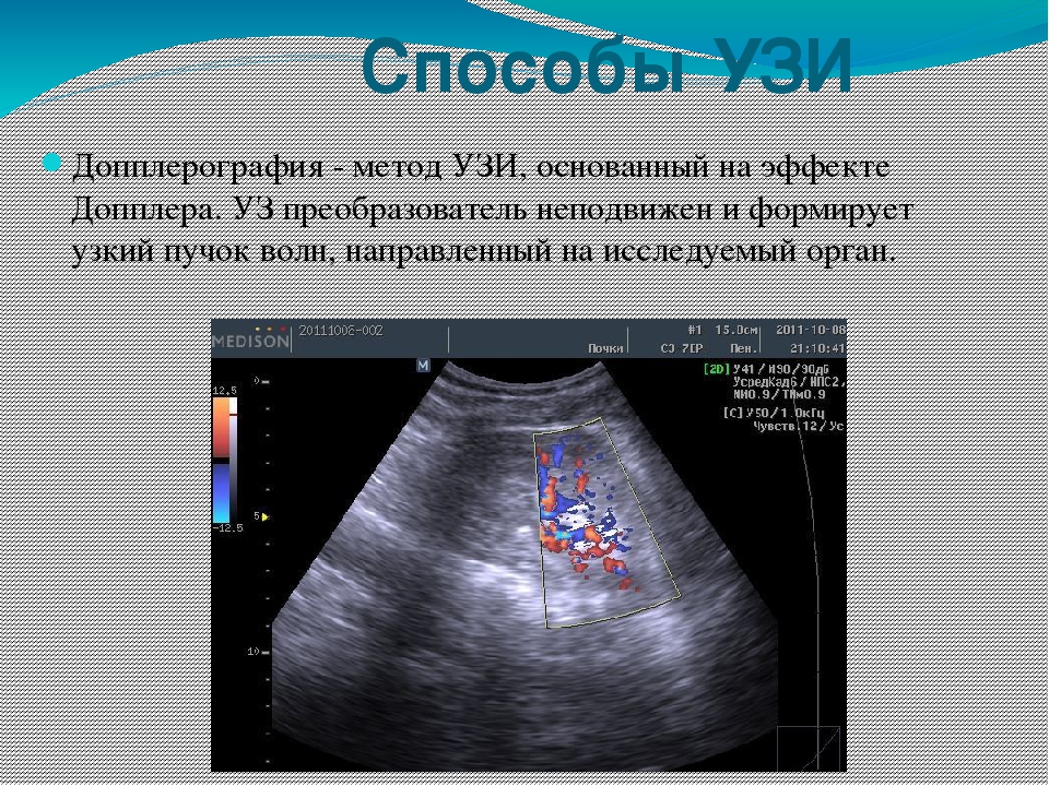 Допплерография. Методики УЗИ. Методики ультразвукового исследования. Ультразвуковой метод исследования. А метод УЗИ.