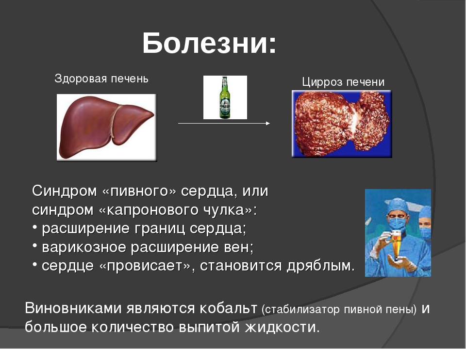 Алкоголь и печень картинки