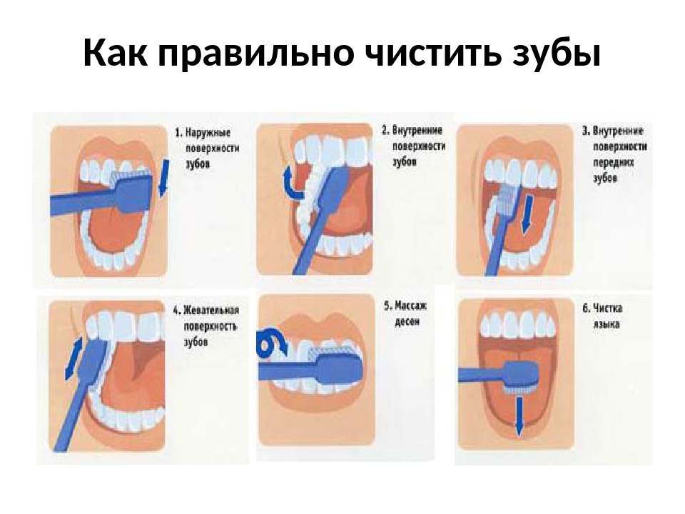 Можно чистить зубы при посте. Алгоритм чистки зубов для дошкольников. Схема чистки зубов. Схема правильной чистки зубов. Правила чистки зубов для детей.