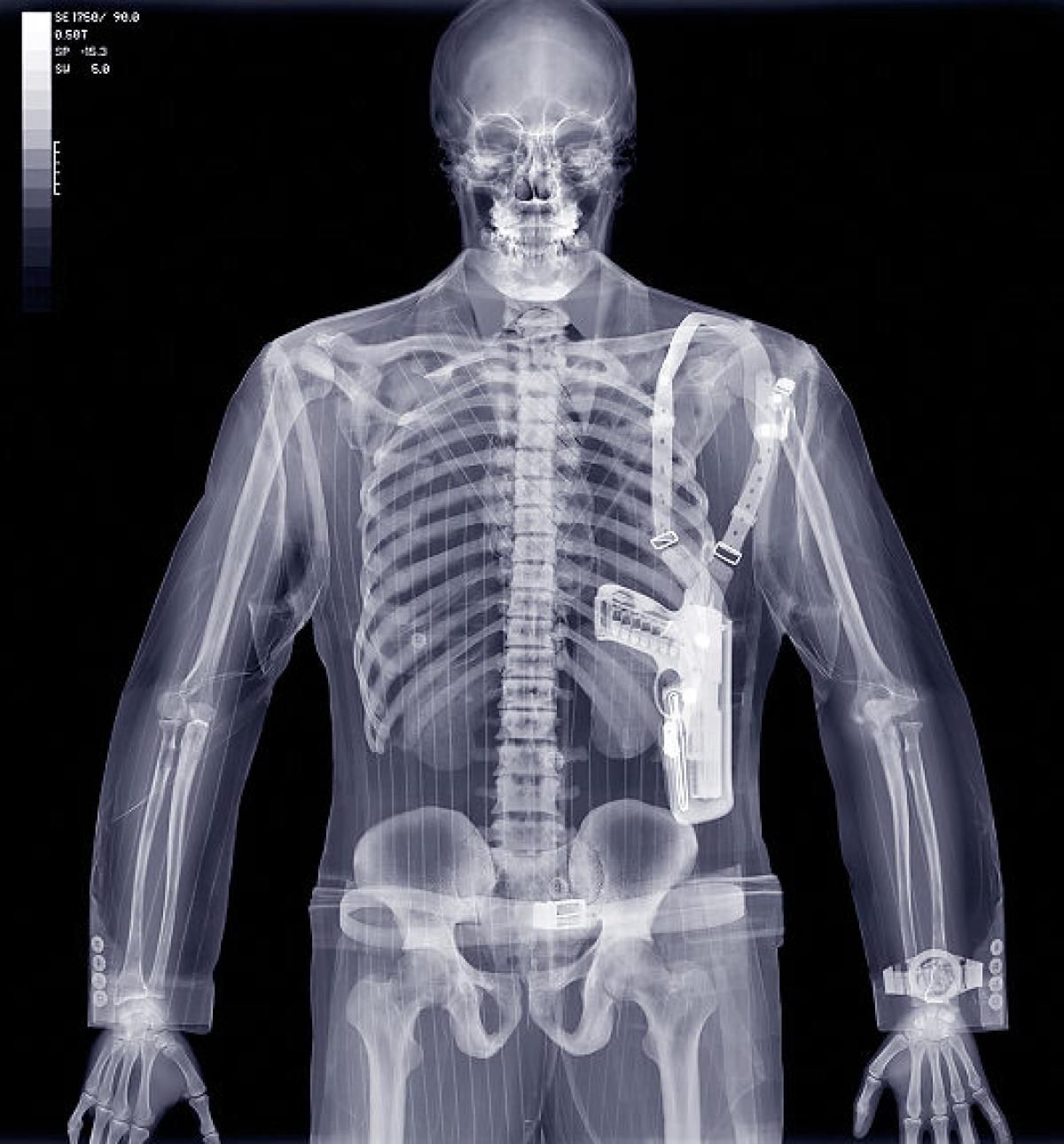 Рентгеновского излучения x- ray