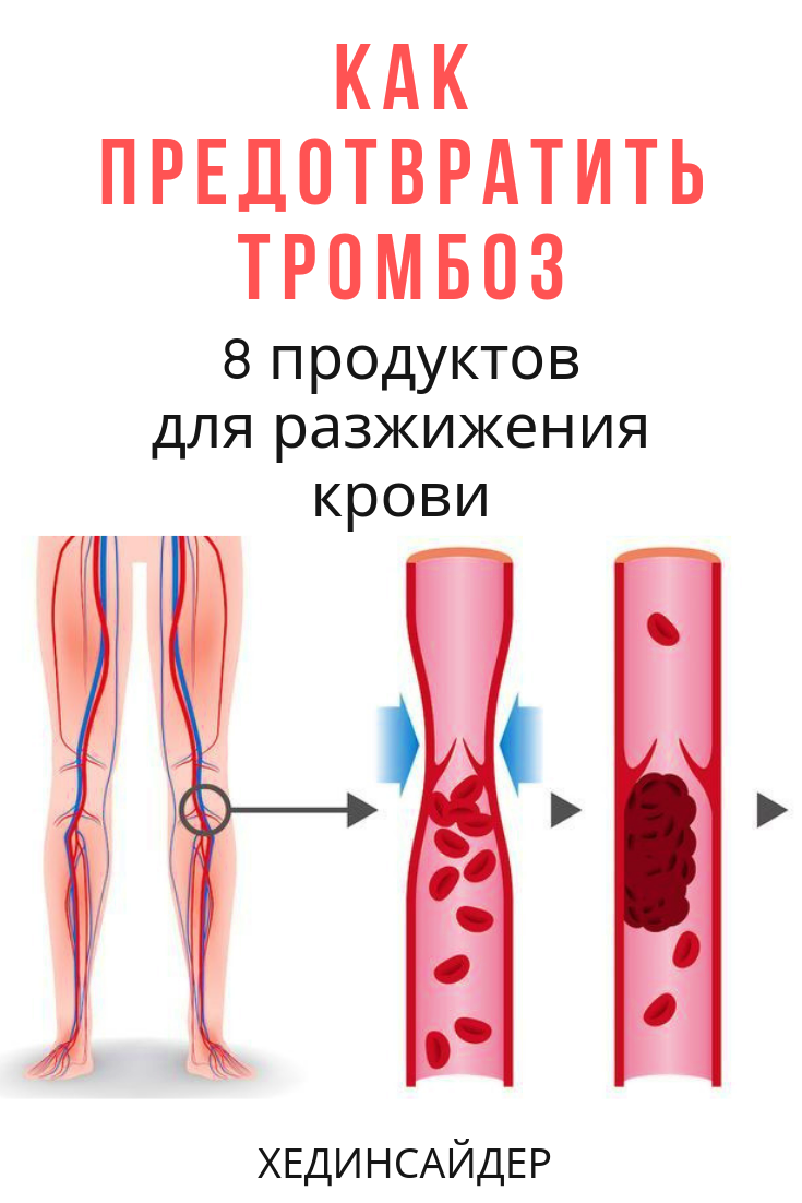 Профилактика тромбоза вен конечностей. Профилактика образования тромбов. Таблетки от тромбов в сосудах. Препараты для предотвращения образования тромбов в сосудах.
