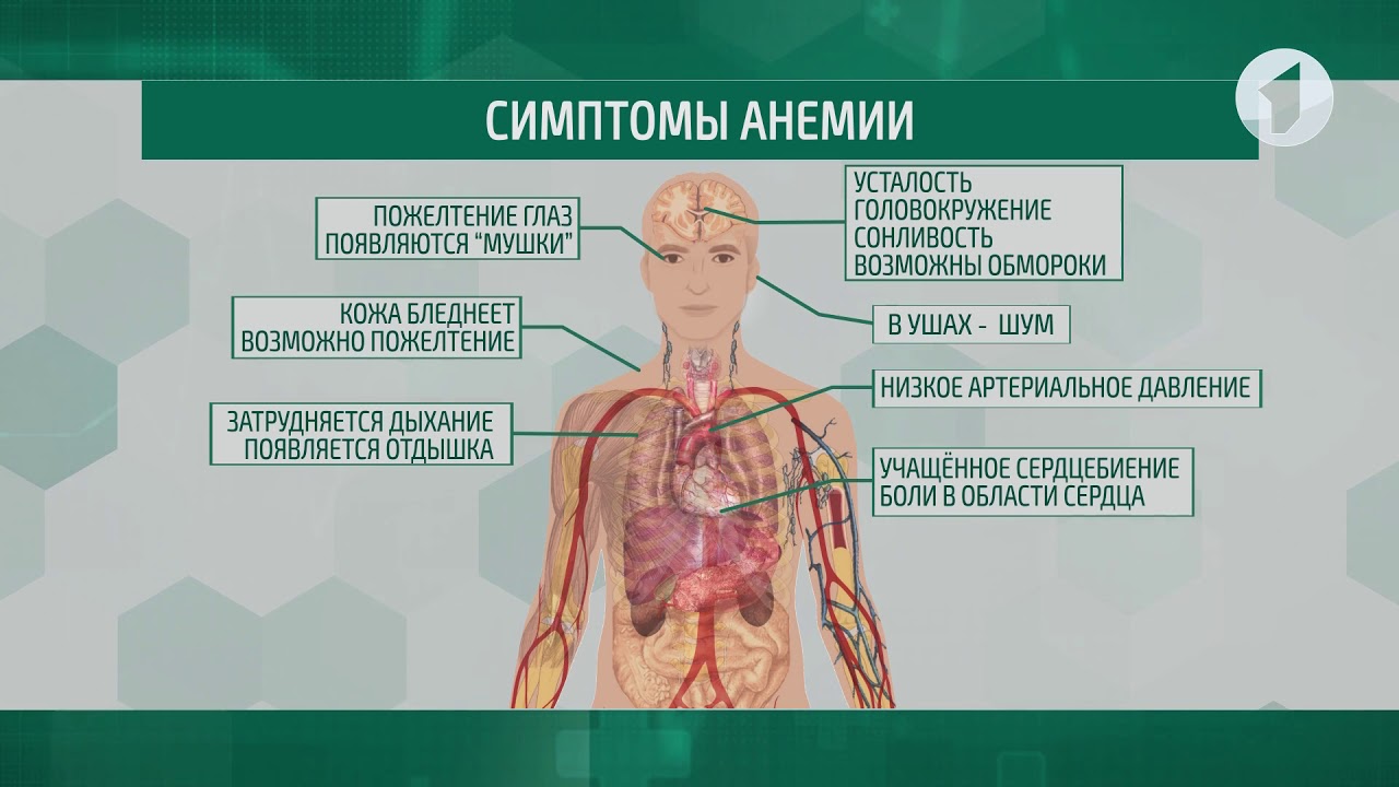 Анемия кома. Низкий гемоглобин симптомы. Признаки низкого гемоглобина.