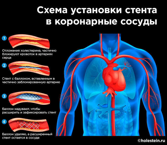 Расширение сосудов