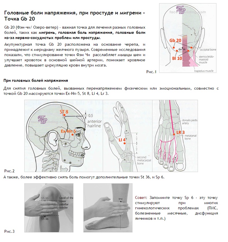 Схема головных болей у человека фото