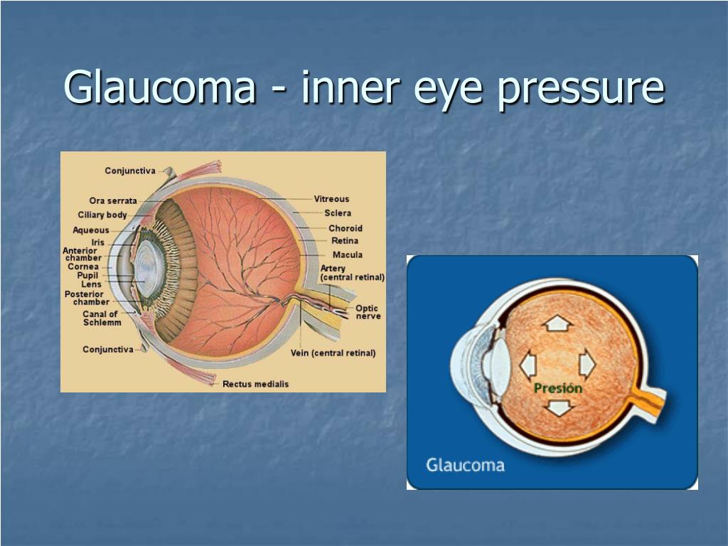 Давлен глаз. Зрение и давление связь. The Inner Eye.