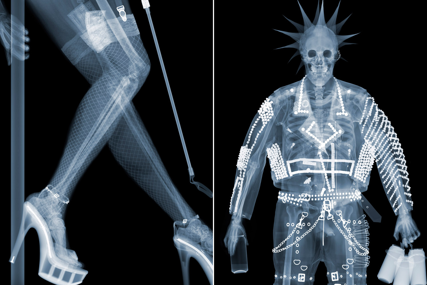 Через рентген. XRAY рентген. Человек в рентгеновских лучах. Съемка в рентгеновских лучах. Старые рентгеновские снимки.