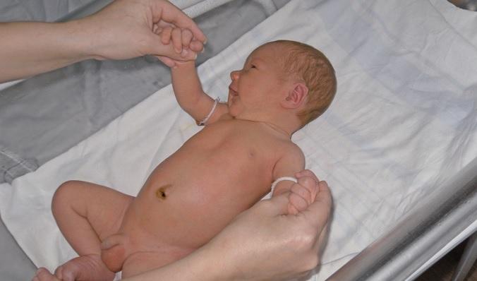 Плоть закрывает головку. Дети с открытой головкой. Половые органы новорожденных мальчиков. Патология половых органов у новорожденных мальчиков.