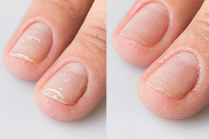 Быстро восстановить ногти после геля. Восстановление ногтевой пластины IVX. IBX для ногтей до и после. IBX система для ногтей до и после. Ногти после IBX.