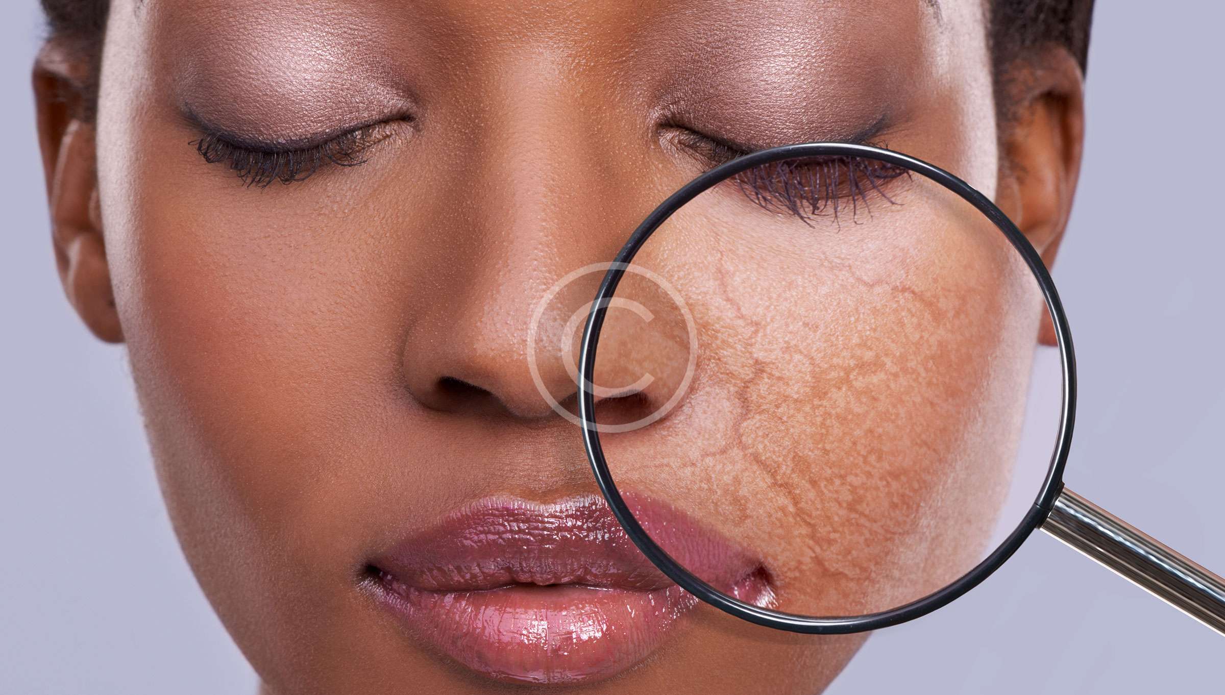 Лечение заболеваний кожи: Заболевания кожи - лечение грибковых .